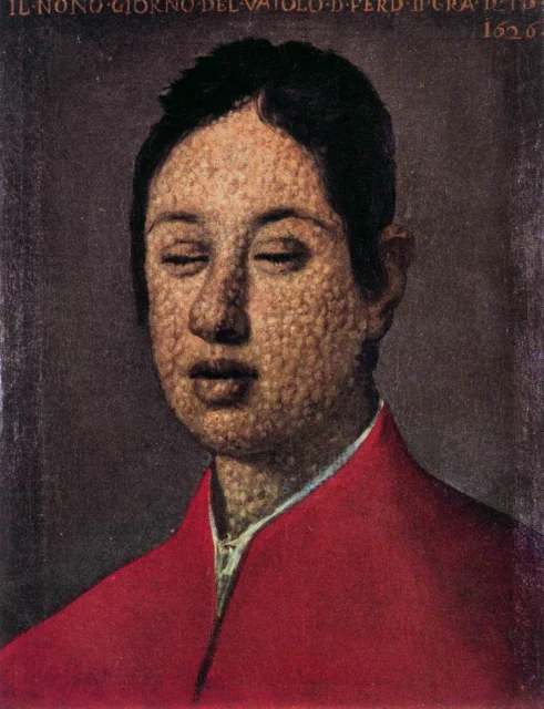 Portrait of Ferdinando II on the Ninth Day of Smallpox